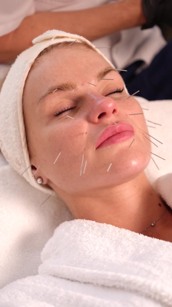 Процедура Face Lifting Acupuncture - акупунктура обличчя