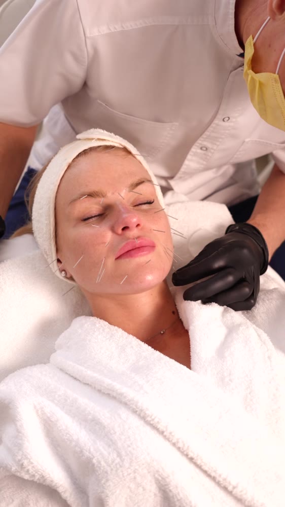 Face Lifting Acupuncture — робота по точках обличчя