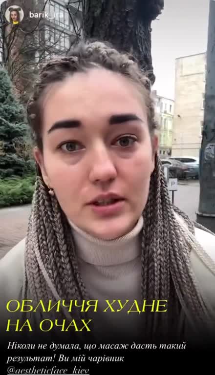 Відеовідгук Ірини про результат масажу обличчя